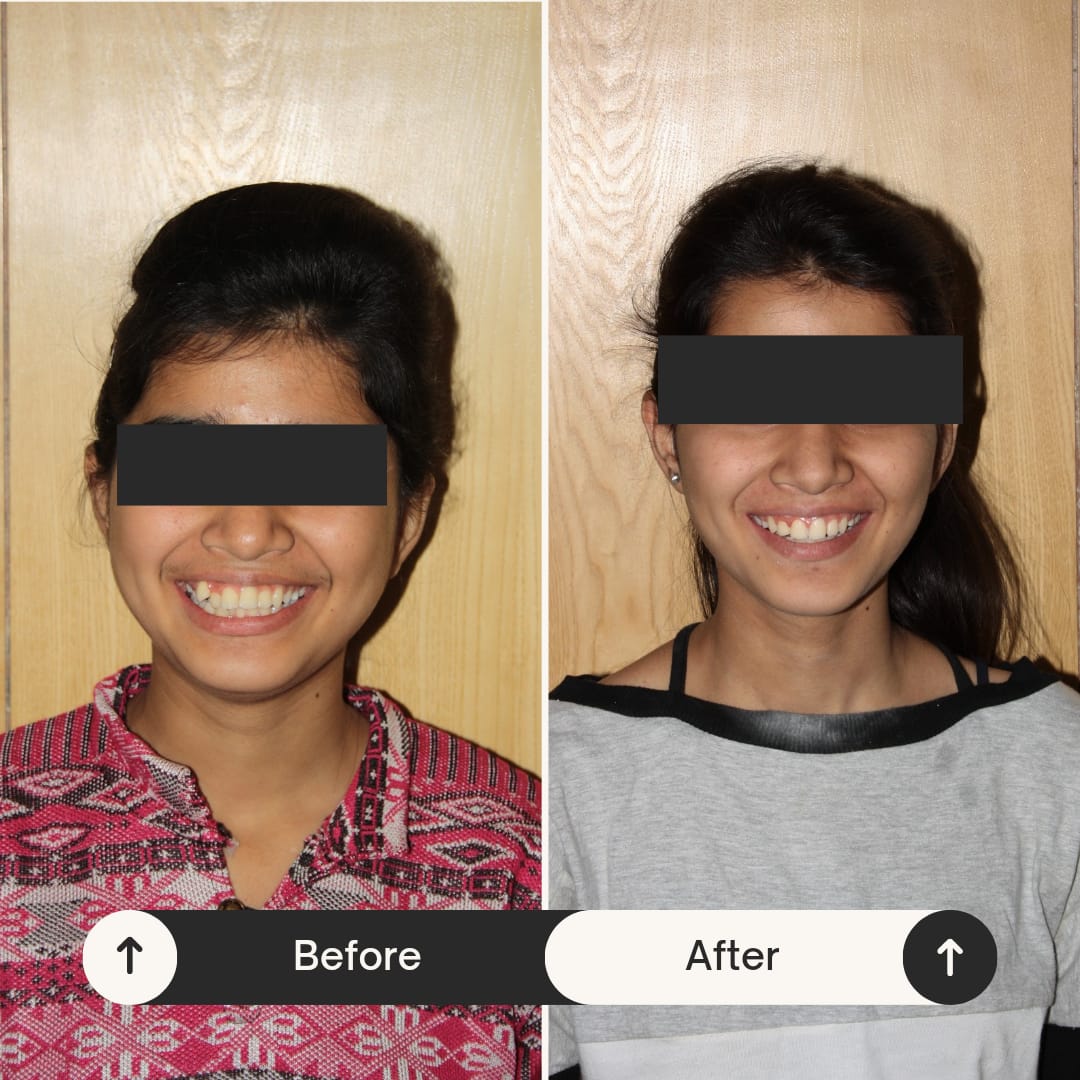orthodontic treatment