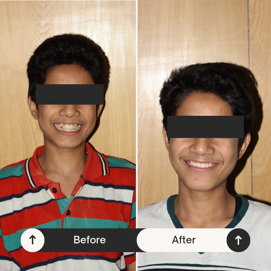 orthodontic treatment