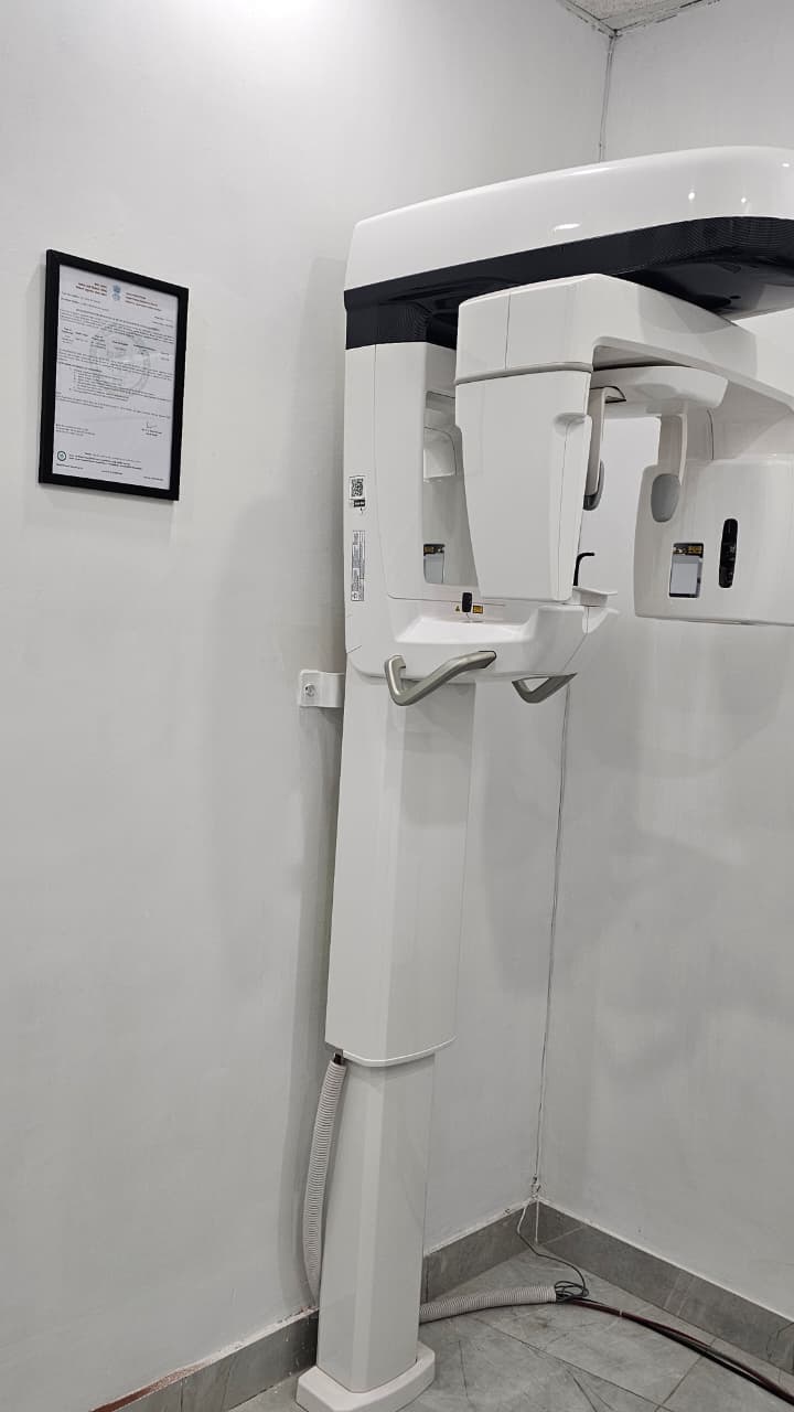 OPG Machine